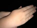 Пупырышки на руке у ребенка, чешутся фото 3