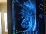 Пол малыша в 12 недель беременности фото 1