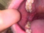Болит внутренняя часть щеки и челюсти фото 1