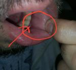 Воспаление на внутренней стороне губы фото 1
