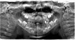 Панорамный снимок зубов ребёнка фото 2