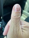 Повреждение ногтя после аппаратного маникюра фото 1
