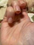 Красные продольные полосы на ногтях после покрытия гель-лаком фото 4
