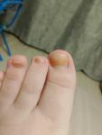 Жёлтые ногти на ногах фото 1