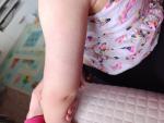 Беспокоит сыпь у ребенка на руках и ногах фото 5