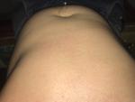 Мелкая розовая сыпь на животе и груди фото 1