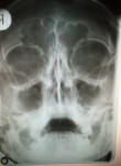 Рентген носовых пазух фото 1