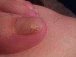 Не понятно что произошло с моим ногтем фото 2