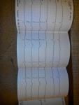 Расшифровка электрокардиогораммы, сильное сердцебиение фото 2