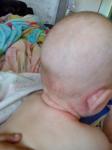 Выступила сыпь на сгибах у ребенка в 6 месяцев фото 4