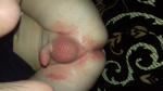 Алергичешский дерматид наверно фото 1