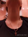 Щитовидная железа подпухла шея фото 1