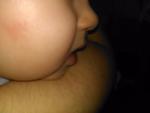 Красное пятнышко на лице у ребёнка в 5 месяцев фото 1