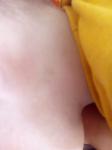 Желтоватые пятнышки за ухом у ребенка фото 1