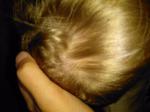 Корочки на голове у 4 х летнего ребенка фото 1