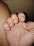 Проблема с кожей и ногтями рук фото 1