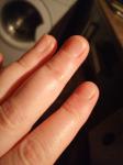 Шишка на пальце руки фото 1