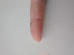 Мелкая еле заметная сыпь на пальце фото 2