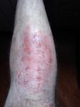 Проблема с кожным покровом на голени левой ноги фото 1