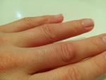Болит кожа на среднем пальце руки фото 1