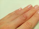 Болит кожа на среднем пальце руки фото 4