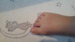 Шишка возле большого пальца ноги у ребенка 2,3 года фото 2