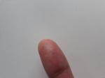 Трещины на пальцах у мастера маникюра фото 3