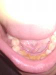 Гниют зубы фото 2