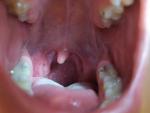 Странное горло (болит) фото 1