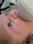 Аллергия или акне у новорожденного фото 2