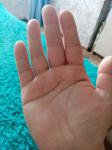 Мраморные ладони вены на пальцах фото 3