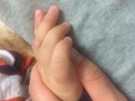 Шишка на пальце руки и ноги дочки 2,5 года фото 2