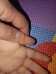 Сухая потемневшая кожа на подушечках пальцев фото 3