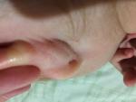 Ногти и кожа за ушком у ребенка фото 1