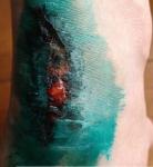 Рана на сгибе ноги фото 2