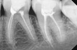 Головокружение после лечения зубов фото 2