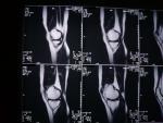 Операция при боли в колене фото 1