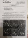 Консультация по результатам МРТ и КТ опухоли головного мозга фото 1
