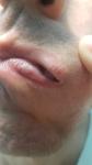Желтоватые точки на губах и в слизистой полости рта фото 1