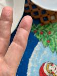 Жжение и микротрещины пальцев рук фото 1