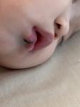 Рваная губа у ребенка фото 1
