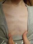 Выступают кости в области груди от нехватки мышц фото 2