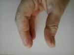 Шершавая коже на пальце, черные трещины фото 1