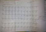 Расшифровка кардиограммы с ИВР фото 1