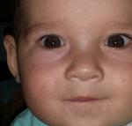 Белые точки на носу у ребенка фото 1