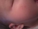 Красные шелушащиеся пятна на груди у трехмесячного малыша фото 2