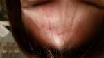 Аллергия на косметику или мыло фото 2