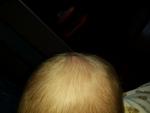 Пятнышко на голове ребенка фото 4