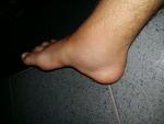 Болит палец на ноге, после падения с байка фото 2