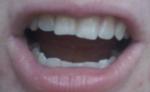 Неровные зубы, как быть? фото 1
